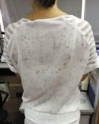 洗衣店如何對付衣服上的泥點(diǎn)